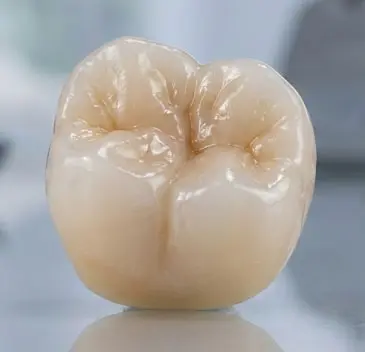 Céramique E-Max et Zircone